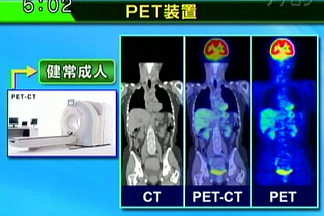 健常者のPET及びCT画像