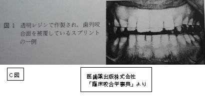 スプリント装着